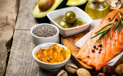 Auswahl an gesunden ungesättigten Fetten, Omega 3 - Fisch, Avocado, Oliven, Nüsse und Samen